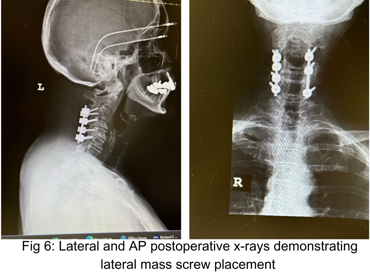 NSPC Brain & Spine Surgery (7) NSPC Brain & Spine Surgery (7)