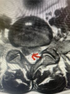 Fig 3b